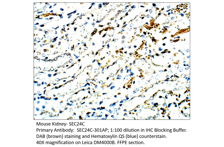 Anti-SEC24C Antibody from FabGennix (SEC24C-301AP) - Antibodies.com