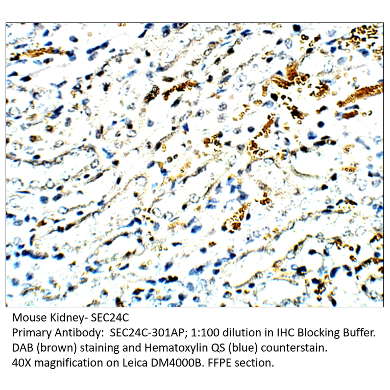 Anti-SEC24C Antibody from FabGennix (SEC24C-301AP) - Antibodies.com