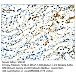 Anti-SEC24C Antibody from FabGennix (SEC24C-301AP) - Antibodies.com