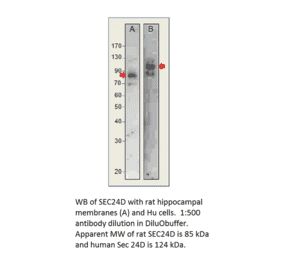 Anti-SEC24D Antibody from FabGennix (SEC24D-401AP) - Antibodies.com