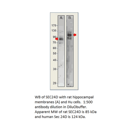 Anti-SEC24D Antibody from FabGennix (SEC24D-401AP) - Antibodies.com