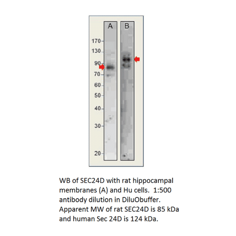 Anti-SEC24D Antibody from FabGennix (SEC24D-401AP) - Antibodies.com