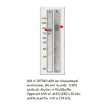 Anti-SEC24D Antibody from FabGennix (SEC24D-401AP) - Antibodies.com