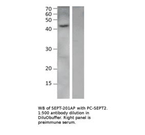 Anti-Septin 2 Antibody from FabGennix (SEPT-201AP) - Antibodies.com