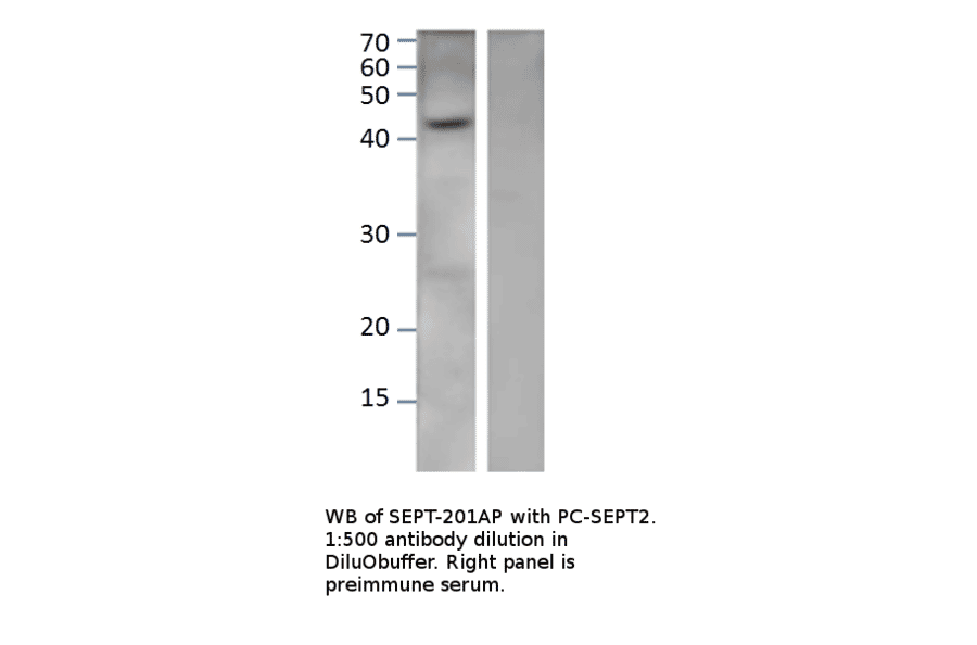 Anti-Septin 2 Antibody from FabGennix (SEPT-201AP) - Antibodies.com