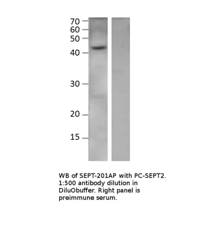 Anti-Septin 2 Antibody from FabGennix (SEPT-201AP) - Antibodies.com