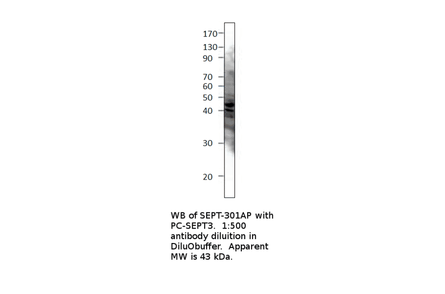 Anti-Septin 3 Antibody from FabGennix (SEPT-301AP) - Antibodies.com