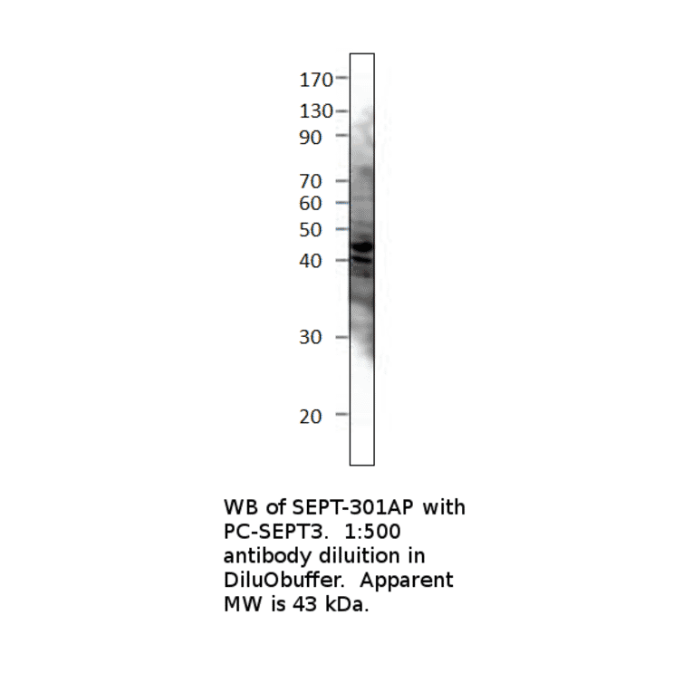 Anti-Septin 3 Antibody from FabGennix (SEPT-301AP) - Antibodies.com