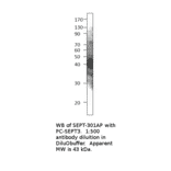 Anti-Septin 3 Antibody from FabGennix (SEPT-301AP) - Antibodies.com