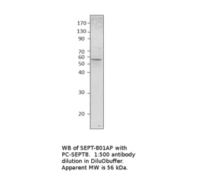 Anti-Septin 8 Antibody from FabGennix (SEPT-801AP) - Antibodies.com