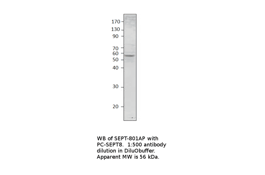 Anti-Septin 8 Antibody from FabGennix (SEPT-801AP) - Antibodies.com