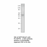 Anti-Septin 8 Antibody from FabGennix (SEPT-801AP) - Antibodies.com