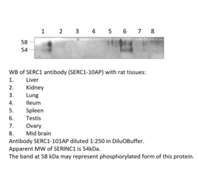 Anti-SERINC1 Antibody from FabGennix (SERC1-101AP) - Antibodies.com