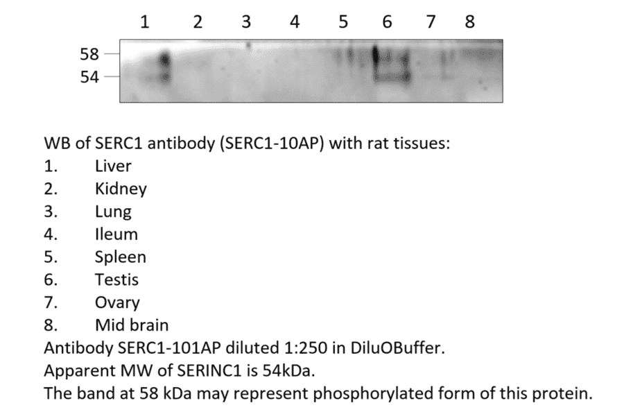 Anti-SERINC1 Antibody from FabGennix (SERC1-101AP) - Antibodies.com