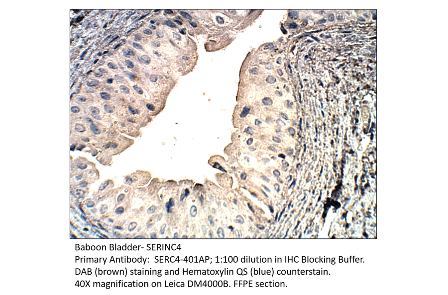 Anti-SERINC4 Antibody from FabGennix (SERC4-401AP) - Antibodies.com