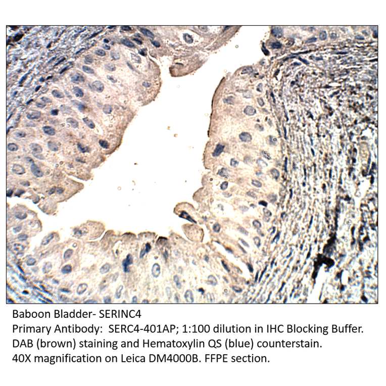 Anti-SERINC4 Antibody from FabGennix (SERC4-401AP) - Antibodies.com