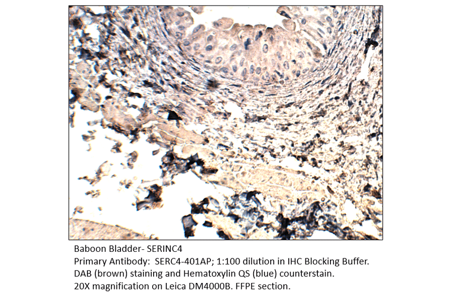 Anti-SERINC4 Antibody from FabGennix (SERC4-401AP) - Antibodies.com