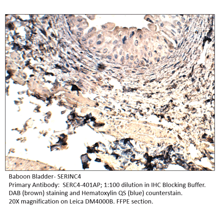 Anti-SERINC4 Antibody from FabGennix (SERC4-401AP) - Antibodies.com