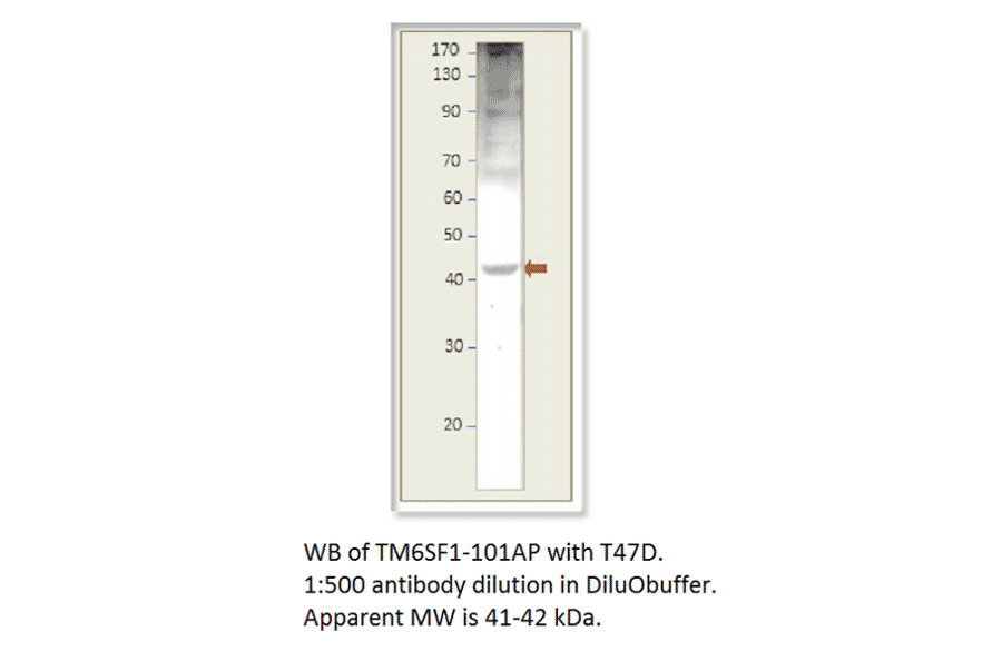 Anti-TM6SF1 Antibody from FabGennix (TM6SF1-101AP) - Antibodies.com