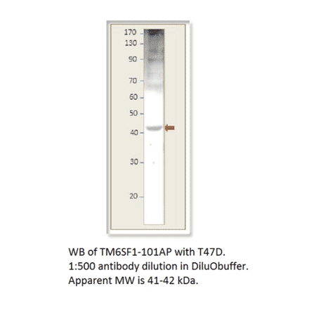 Anti-TM6SF1 Antibody from FabGennix (TM6SF1-101AP) - Antibodies.com