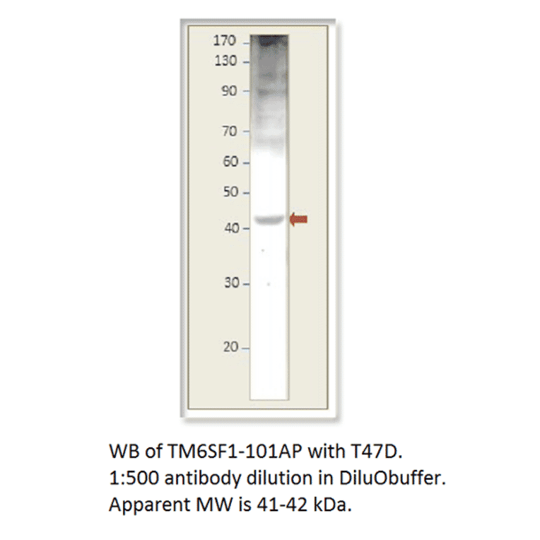 Anti-TM6SF1 Antibody from FabGennix (TM6SF1-101AP) - Antibodies.com