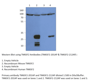 Anti-TM6SF2 Antibody from FabGennix (TM6SF2-201AP) - Antibodies.com