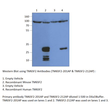 Anti-TM6SF2 Antibody from FabGennix (TM6SF2-201AP) - Antibodies.com