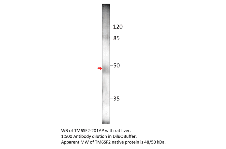 Anti-TM6SF2 Antibody from FabGennix (TM6SF2-201AP) - Antibodies.com