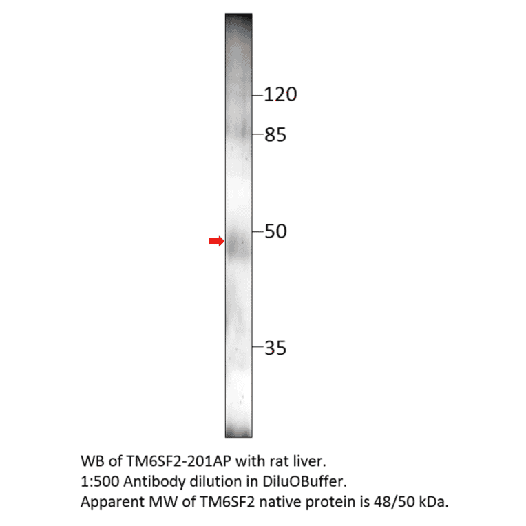 Anti-TM6SF2 Antibody from FabGennix (TM6SF2-201AP) - Antibodies.com