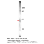Anti-TM6SF2 Antibody from FabGennix (TM6SF2-201AP) - Antibodies.com