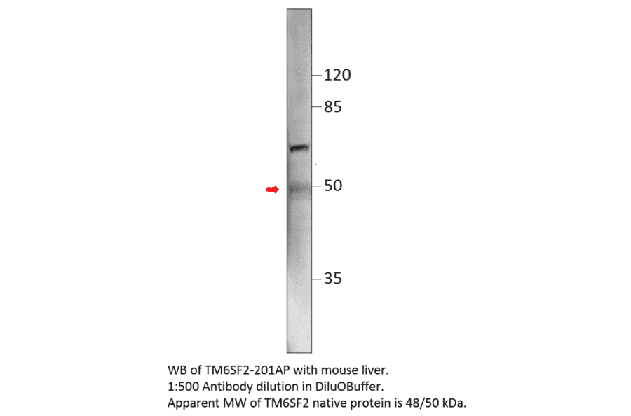 Anti-TM6SF2 Antibody from FabGennix (TM6SF2-201AP) - Antibodies.com