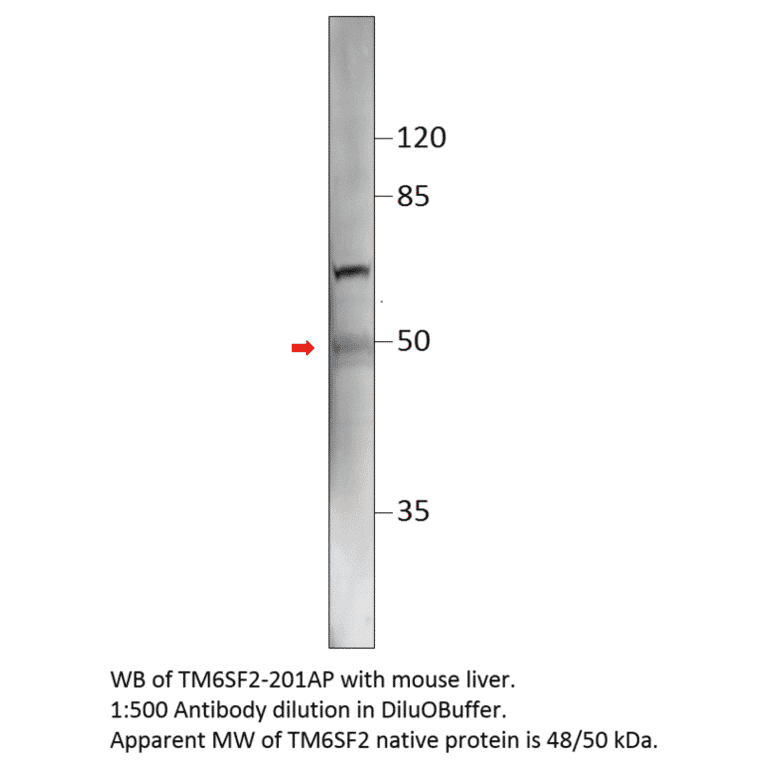 Anti-TM6SF2 Antibody from FabGennix (TM6SF2-201AP) - Antibodies.com