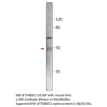Anti-TM6SF2 Antibody from FabGennix (TM6SF2-201AP) - Antibodies.com
