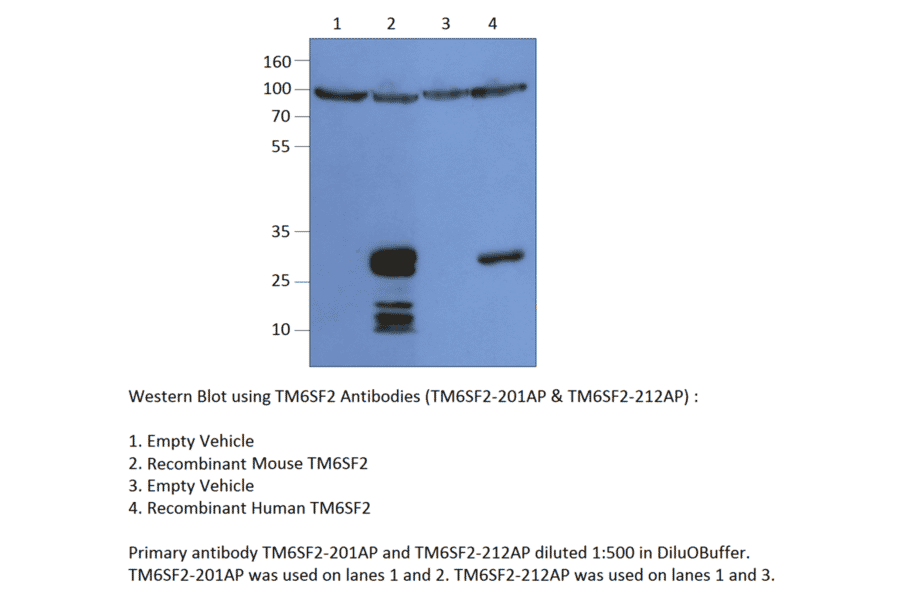 Anti-TM6SF2 Antibody from FabGennix (TM6SF2-212AP) - Antibodies.com