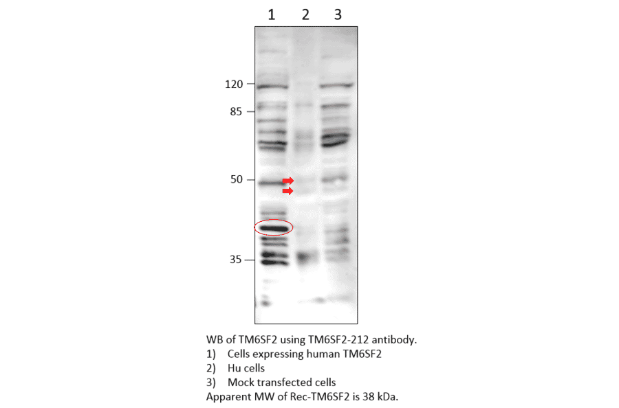 Anti-TM6SF2 Antibody from FabGennix (TM6SF2-212AP) - Antibodies.com