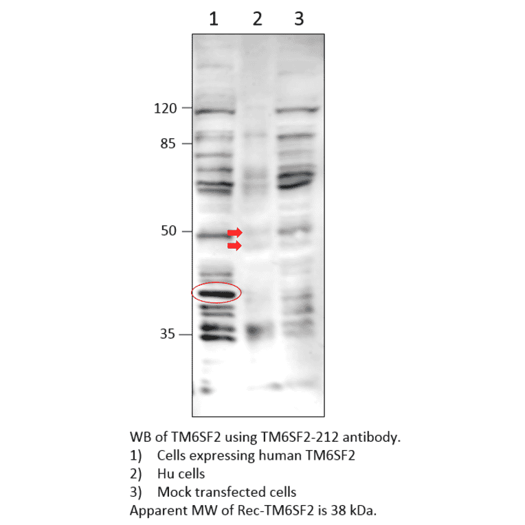 Anti-TM6SF2 Antibody from FabGennix (TM6SF2-212AP) - Antibodies.com