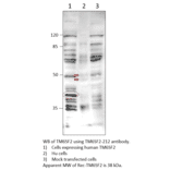 Anti-TM6SF2 Antibody from FabGennix (TM6SF2-212AP) - Antibodies.com