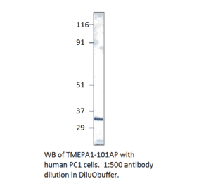 Anti-TMEPAI Antibody from FabGennix (TMEPA1-101AP) - Antibodies.com