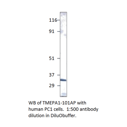 Anti-TMEPAI Antibody from FabGennix (TMEPA1-101AP) - Antibodies.com