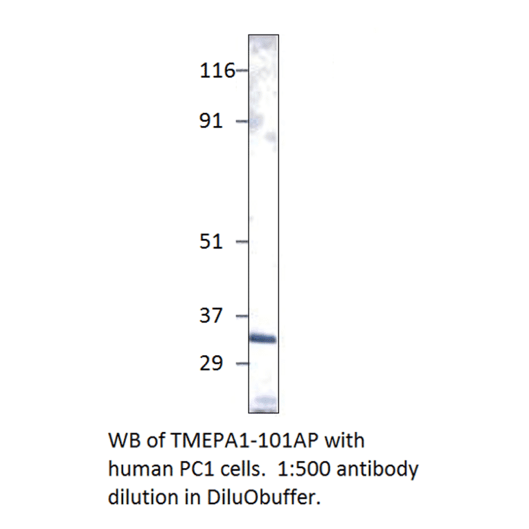 Anti-TMEPAI Antibody from FabGennix (TMEPA1-101AP) - Antibodies.com