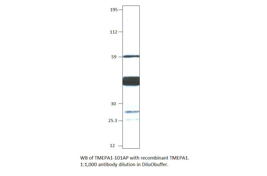 Anti-TMEPAI Antibody from FabGennix (TMEPA1-101AP) - Antibodies.com