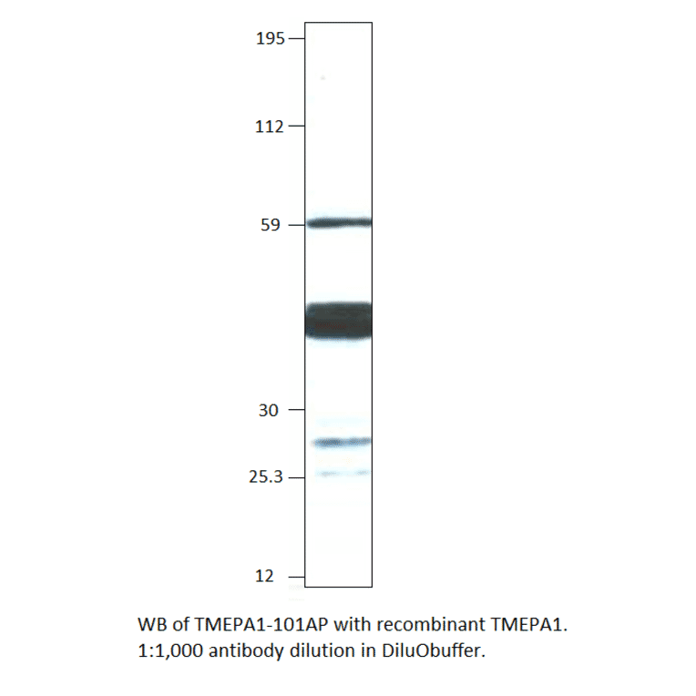 Anti-TMEPAI Antibody from FabGennix (TMEPA1-101AP) - Antibodies.com