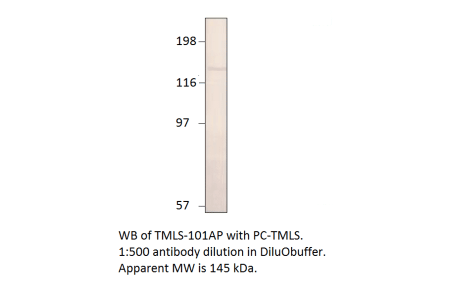 Anti-Timeless Antibody from FabGennix (TMLS-101AP) - Antibodies.com