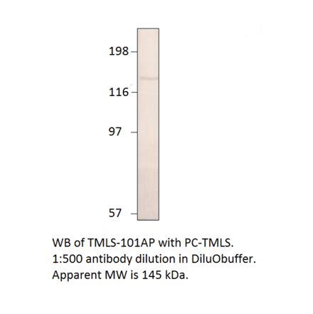 Anti-Timeless Antibody from FabGennix (TMLS-101AP) - Antibodies.com