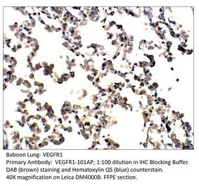 Anti-VEGFR1 Antibody from FabGennix (VEGFR1-101AP) - Antibodies.com