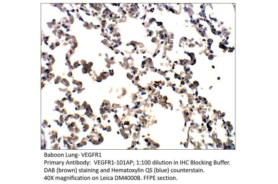 Anti-VEGFR1 Antibody from FabGennix (VEGFR1-101AP) - Antibodies.com