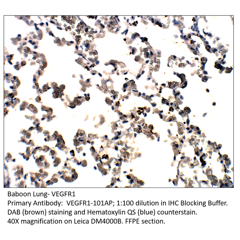 Anti-VEGFR1 Antibody from FabGennix (VEGFR1-101AP) - Antibodies.com