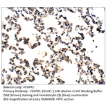 Anti-VEGFR1 Antibody from FabGennix (VEGFR1-101AP) - Antibodies.com