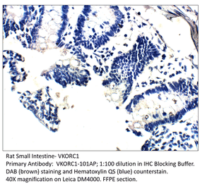 Anti-VKORC1 Antibody from FabGennix (VKORC1-101AP) - Antibodies.com