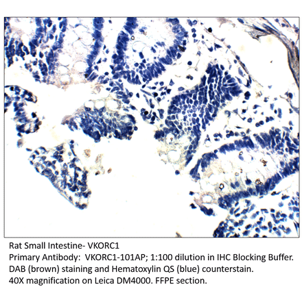 Anti-VKORC1 Antibody from FabGennix (VKORC1-101AP) - Antibodies.com